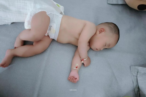 沈丘宝宝头上长痱子